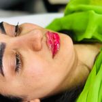 مرکزکلینیک لیزر زیبایی پوست و مو آسا