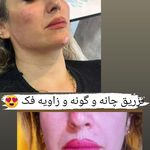 کلینیک زیبایی و لیزر دکتر رز