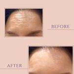 کلینیک لیزر هایفو اندولیفت لکسیر