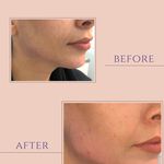 کلینیک لیزر هایفو اندولیفت لکسیر