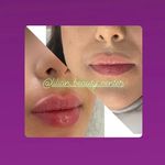 كلينيک پوست، مو و زیبایی ليليان