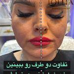 کلینیک تخصصی لیزر و لیفت نخ لولیتا