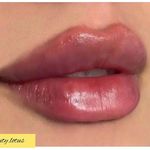 کلینیک پوست و مو و لیزر نیلوفر آبی