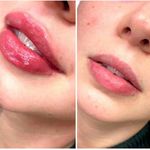 کلینیک پوست و مو و لیزر نیلوفر آبی