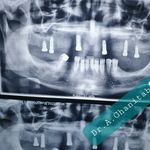 دندانپزشکی دکتر غنی طبع و دکتر تیموری