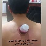 حجامت، زالو درمانی، فصدخون.برداشتن خال امجدیان
