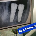 دندانپزشکی دکتر غنی طبع و دکتر تیموری