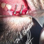 دندانپزشکی دکتر غنی طبع و دکتر تیموری