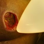 مرکز خدمات پرستاری درمانی یاسین زخم بستر