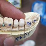 فروش دستگاه و مواد دندان سازی معین