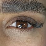 کاشت مژه نچرال