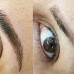 فیبروز میکروبلیدینگ و خدمات تاتو ابرا