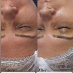 خدمات فیشیال و پوست مریم علا