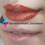 آرایش دائم صورت : میکروبلیدینگ ابرو ، میکرو پیگمنتیشن ،
