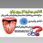 طب سنتی ولیدی