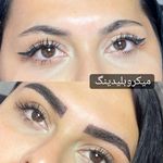 مرکز تخصصی میکروبلیدینگ، اسکالپ و ریموو بانو زهرا مطوریان