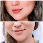 کلینیک لیزر و زیبایی دایان