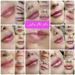 مرکز لیزر کلینیک زیبایی دکتر نگار وکیلی