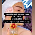 پاکسازی وفیشال اتاق پوست آزیتا