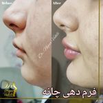 مرکز لیزر کلینیک زیبایی دکتر نگار وکیلی