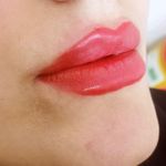 کلینیک زیبایی زرین
