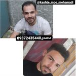 مرکز تخصصی کاشت مو محمدی