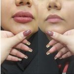 کلینیک پوست و لیزر پرنیان