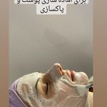 پاکسازی و فشیال تخصصی پوست فاطمه توکلی