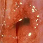 مطب مامایی زهرا غلامی