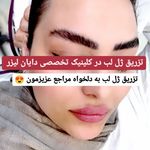 کلینیک لیزر و زیبایی دایان