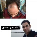 مرکز تخصصی کاشت مو محمدی