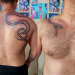 تاتو بدن ،ژل و بوتاکس