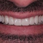 معصومه جعفری متخصص ایمپلنت فوری