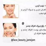 انجام خدمات مزونیدلینگ ، میکرونیدلینگ ،هایفو تراپی و ... (فیس بیوتی)