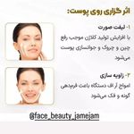 انجام خدمات مزونیدلینگ ، میکرونیدلینگ ،هایفو تراپی و ... (فیس بیوتی)