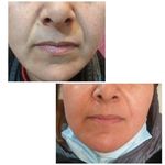 مرکز لیزر و کلینیک زیبایی دکتر خانجانی