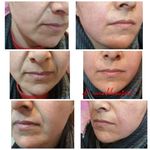 مرکز لیزر و کلینیک زیبایی دکتر خانجانی