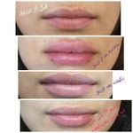 مرکز لیزر و کلینیک زیبایی دکتر خانجانی