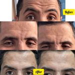 مرکزکلینیک لیزر زیبایی پوست و مو آسا