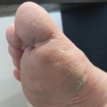 پدیکور آقایان