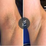 کلینیک زیبایی ،لیزر و لاغری گل مریم