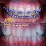 کلینیک دندانپزشکی مهر شریعتی