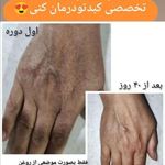 مشاوره رایگان تشخیص بیماریها از روی زبان