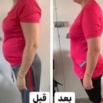 مشاوره رایگان تشخیص بیماریها از روی زبان