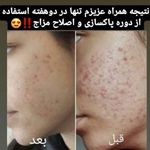 مشاوره رایگان تشخیص بیماریها از روی زبان