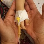 پزشکی پرستاری در منزل برکه