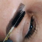 میکروبلیدینگ و فیبروز ابرو