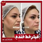 کلینیک تخصصی زیبایی و لیزر کوروش