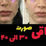 پودر جوانه گندم