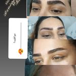 میکروبلیدینگ پریسا رجبی